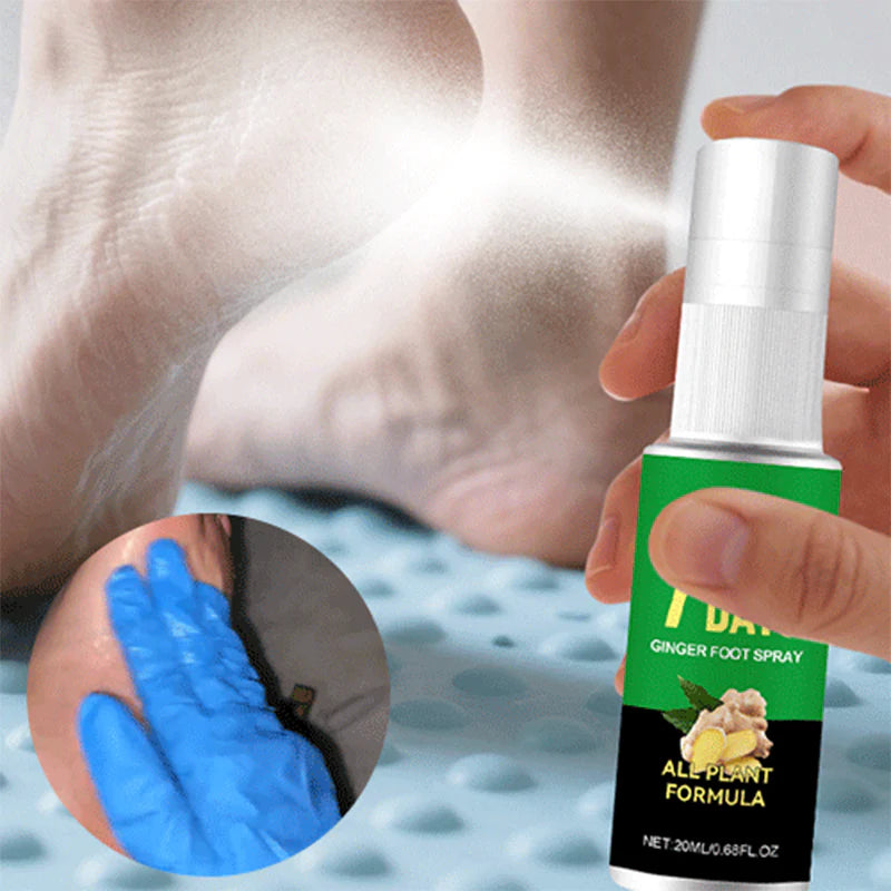 🔥Kup 1 dostaneš 1 zdarma🔥Exfoliační sprej na nohy se zázvorem – 7 dní
