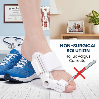 🦶✨ Korektor na hallux valgus – úleva od bolesti a narovnání palce