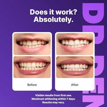 🦷Fialové bělící proužky na zuby proti zažloutnutí zubů – ústní čisticí gel pro zářivý úsměv s dlouhotrvajícím účinkem